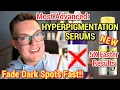 FADE DARK SPOTS FAST - Best Dark Spot Serums 2026