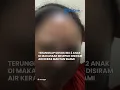 Download Lagu Terungkap Sosok Ibu 2 Anak di Makassar Melepuh Disiram Air Keras Mantan Suami