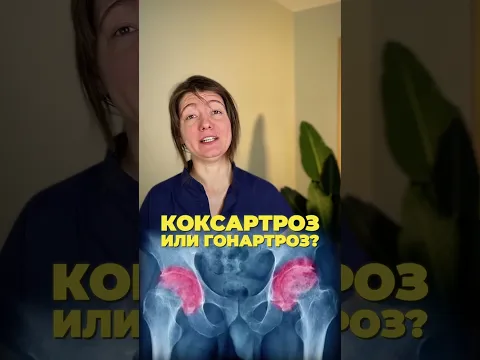 Не лечите АРТРОЗ, пока не узнаете ЭТО!