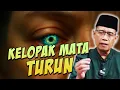 Download Lagu SAKIT KELOPAK MATA TURUN