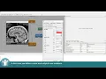 MeVisLab Tutorials - Contours