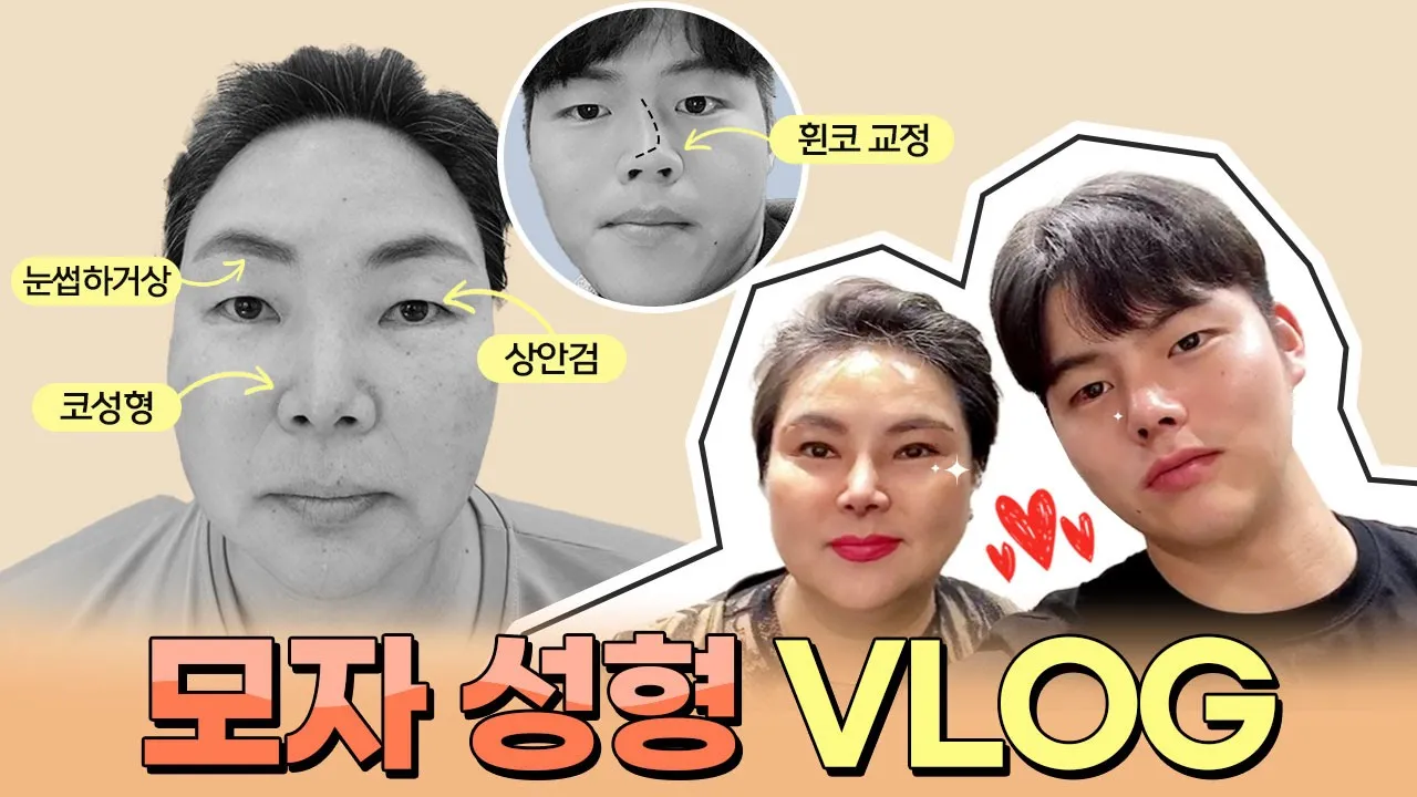 [VLOG] 엄마와 아들이 함께 성형수술 하러 옴!❤️모자 성형 리얼후기 [휜코 교정, 상안검, 눈썹하거상]