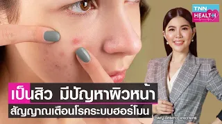 สิวเกิดจากอะไรบ้าง และมีลักษณะอย่างไร