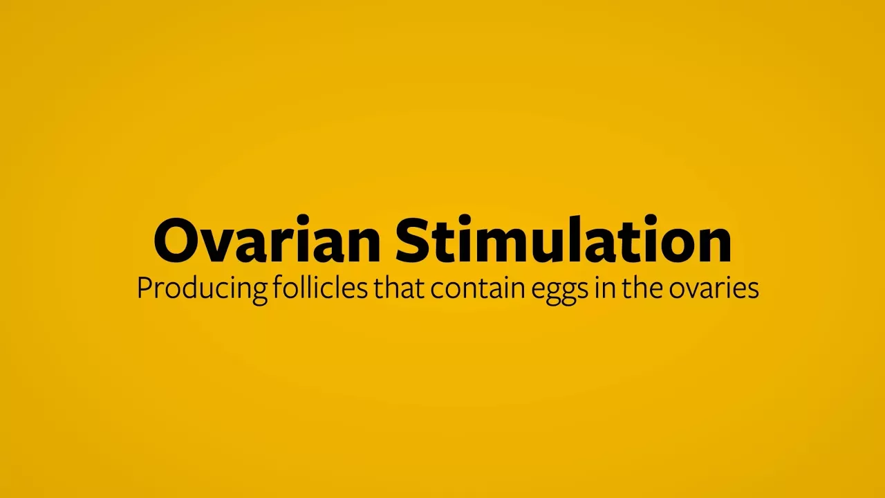 In Vitro Fertilization Ovarian Stimulation