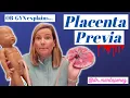 Placenta Previa A cause of bleeding in pregnancy OBGYN explains what it means why it matters