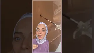 إبرة الظهر أثناء الولادة 