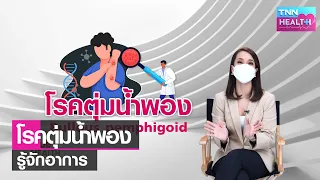 การรักษาโรคตุ่มน้ำพองใช้ยาอะไร และต้องระวังอย่างไร