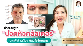 การรักษาโรคปวดหัวคลัสเตอร์มีวิธีใดที่ได้ผลดี โดยเฉพาะในช่วงที่มีอาการกำเริบ