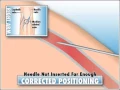 Needle not inserted far enough