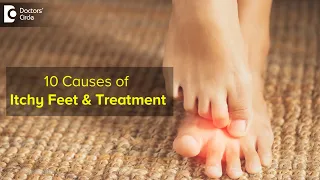 10 CAUSES OF ITCHY FEET How to get relief Right Treatment - Dr Urmila Nischal Doctors Circle