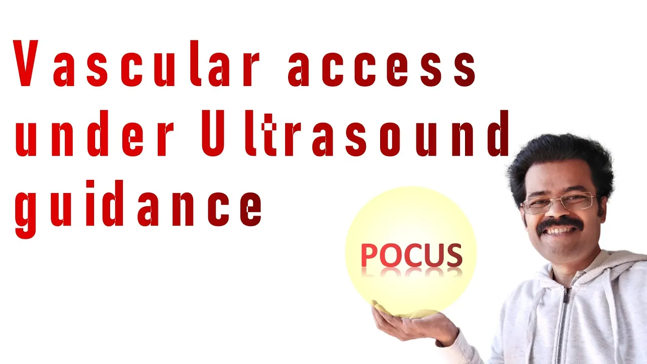 Ultrasound guided vascular acces: How Ultrasound is Revolutionizing IV Access