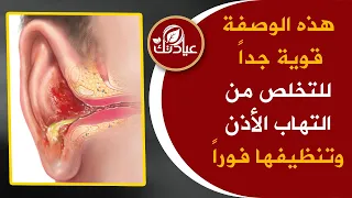 هذه الوصفة تعالج التهاب الاذن بأسرع مما تتوقع نظف أذنك بهذه الطريقة وستتعجب مماستراه في هذا الفيديو  هذه الوصفة تعالج التهاب الاذن بأسرع مما تتوقع نظف أذنك بهذه الطريقة وستتعجب مماستراه في هذا الفيديو