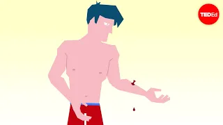 ทำไมแผลที่ลึกถึงชั้นหนังแท้จึงอาจไม่ฟื้นตัวกลับมาเหมือนเดิมได้