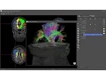 BrainMagix 2 1 Constrained spherical deconvolution-based tractography