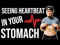 Seeing Feeling Your Heartbeat or Pulse In Your Stomach - Health Anxiety Nightmare