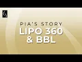 BBL Lipo 360 Testimonial by Dr Charepoo at Mia Aesthetics