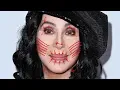 Removing CHER S Plastic Surgery