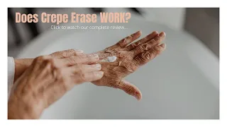Crepe erase reviews crepe erase treatment Crepey skin Erase Reviews 2020 remove Crepey Skin