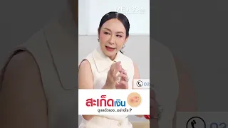  สะเก็ดเงินเป็นโรคผิวหนังชนิดใด และมีสาเหตุจากอะไรบ้าง 