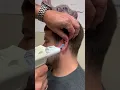 Download Lagu Watching hearing aid impressions be made is so satisfying! #audiology #satisfying #oddlysatisfying