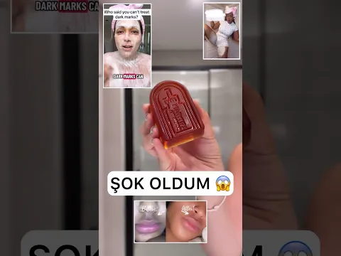 BEMBEYAZ LEKESİZ KOLTUK ALTI ŞOK OLACAKSIN #ciltbakımı #keşfet