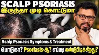 Scalp Psoriasis-ஆ? Dandruff-ஆ? 😱 எப்படி கண்டுபிடிப்பது? Symptoms & Treatment | Dr Herbal