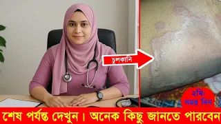 চুলকানি শুধু অস্বস্তি নয়—এর পেছনে থাকতে পারে বেশ কিছু গুরুত্বপূর্ণ কারণ