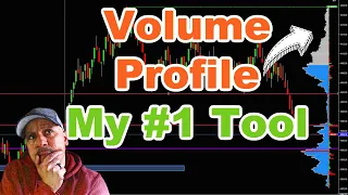 Stop Guessing Entries Why Volume Profile is the ONLY Futures Indicator You Need to Trade MES