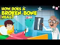 Download Lagu How Bone Fractures Heal? | How Does a Broken Bone Heal? | Process of Bone Healing | Dr. Binocs Show