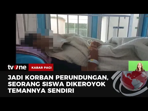 Alami Luka & Trauma, Pelajar di Asahan Dikeroyok Teman