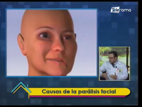 Causas de la parálisis facial 