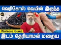 அருமையான வீட்டு வைத்தியம் | Vericose vein remedy | Wellness Guruji | Health tips | Doctor Plus