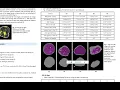 Segmentation of the Fascia Lata in Magnetic Resonance Images of the Thigh