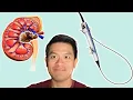 Choosing the right surgery for your kidney stone
