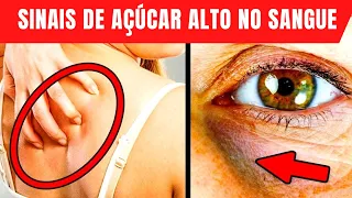 13 SINTOMAS DESCONHECIDOS DE AÇÚCAR ALTO NO SANGUE [GLICOSE ALTA]