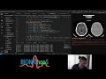 Image Compression using Wavelet Transform Part 3
