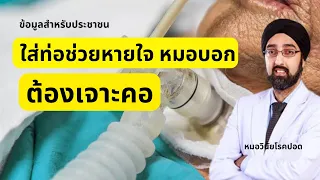 ทำไมผู้ป่วยที่ใช้เครื่องช่วยหายใจนานๆ จึงควรย้ายท่อจากปากมาที่คอ?