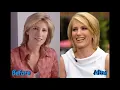 Laura Ingraham Plastic Surgery Nothing More Than A Gossip