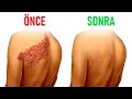 Download Lagu Zonadan Kalıcı Olarak Nasıl Kurtulur? | Dr.Berg Türkçe