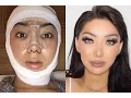 My Facial Plastic Surgery Story Dragun