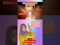 +tips melahirkan Normal Tanpa jahitan#Pembukaan Persalinan#video