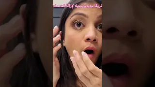 ازالة العدسات بسهولة  ازالة العدسات بسهولة