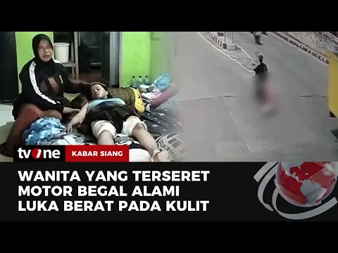 Kondisi Terkini Wanita di Bekasi Usai Terseret Begal 100 Meter