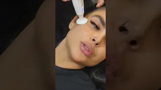 نصب و آموزش دستگاه پلاسما جت   پلکسر   جوانسازی  لیفت صورت  شورت  لیزر                   دندنها
