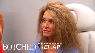 Bologna Sized Areolas to Pepperoni Size Botched Recap S6 E20 E