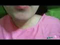 Threading lower upper lip laybare with messi