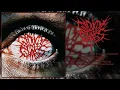 Download Lagu GIRL OF GLASS - SELF-TITLED [FULL DEMO/EP] (MYSPACE REVIVAL DEATHCORE - 2024)