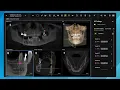 DS Core - Diagnose Features Smart View