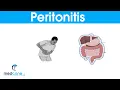 Peritonitis causes signs and symptoms and treatment
