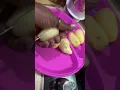 Download Lagu #recipe #recipe Kerala, Aloo, Beggin mix on G